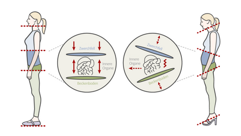 Eine Illustration, wie Absätze Ihre Haltung beeinflussen. Eine Frau in flachen Schuhen steht gerade, während bei einer Frau in Absatzschuhen eine Neigung der Füße, des Beckens und des Zwerchfells auftritt.