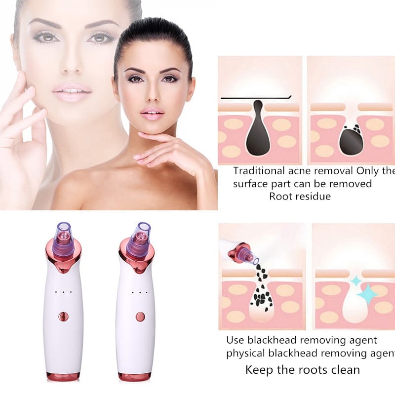 Blackhead Remover Vacuum