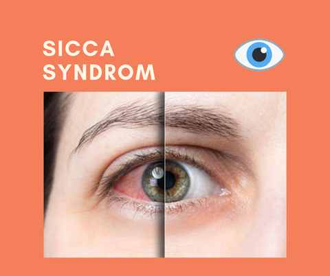 Sicca Syndrom trockene Augen