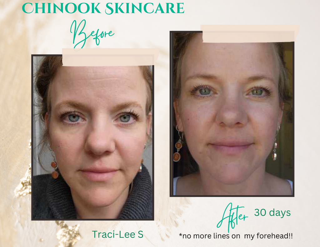 Tracy's before & after photo after using Chinook Skincare system