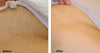 No Grow Intimate Hair Remover - Bikini Wax before and after