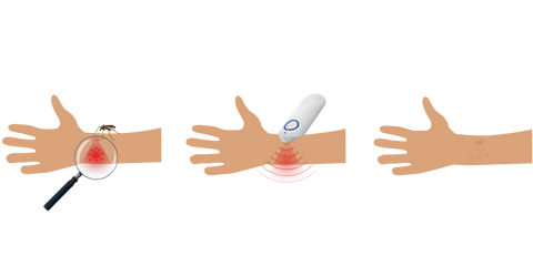 Hands on which the healing of a stab is shown by a stabilizer