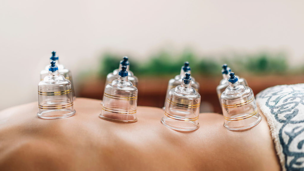 Cupping therapy is used by many of the world's leading athletes