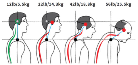 SCM Trigger Points