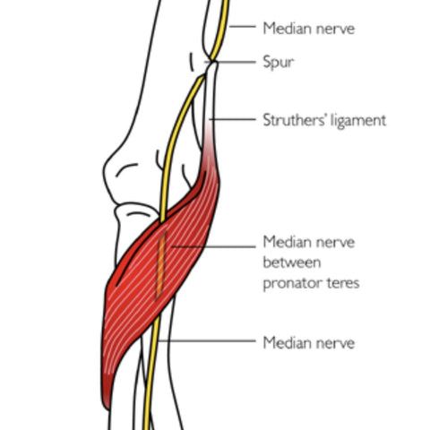 Terapia de puntos gatillo del nervio mediano