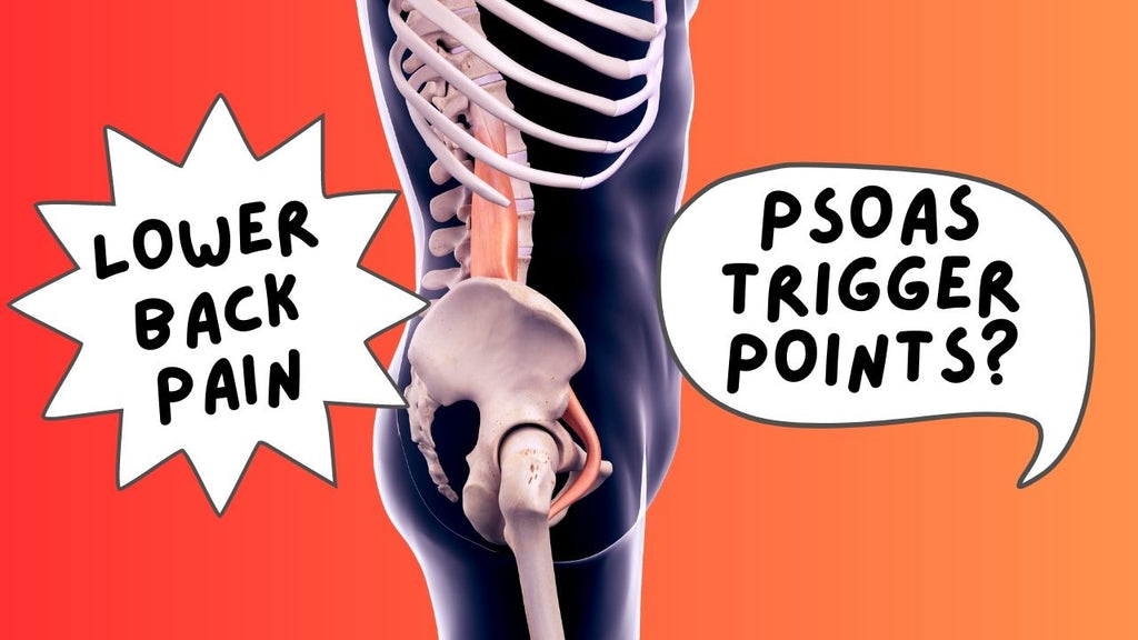 Psoas Trigger Points and Low Back Pain
