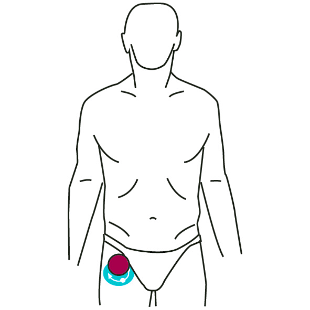 Rectus Femoris Quadriceps Massage