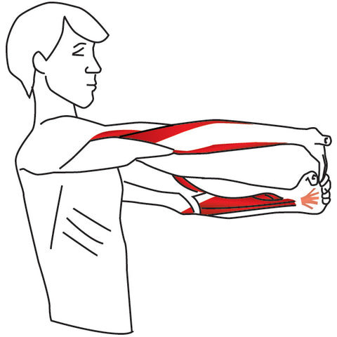 Rehab and Injury Prevention for Wrist and Elbow Pain | Elbow, Triceps ...