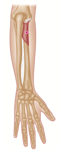 Supinator Trigger Points