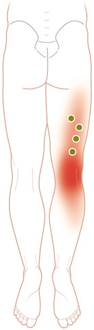 Puntos de activación del bíceps femoral