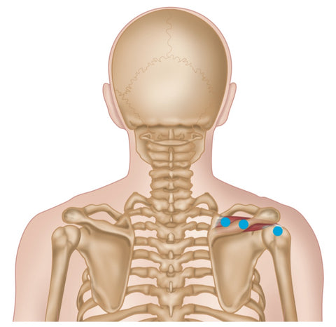 Supraspinatus-Triggerpunkte