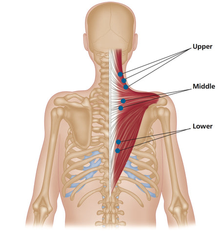 Trapezius-Triggerpunkte