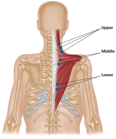 Trapezius-Triggerpunkte