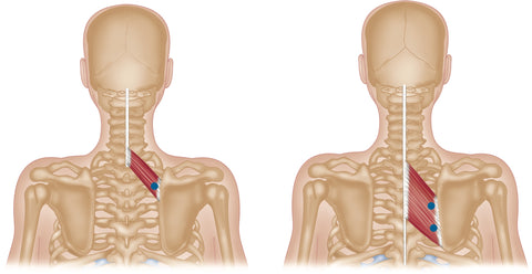 Rhomboide Triggerpunkte