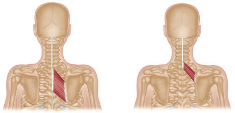 Rhomboid Major Rhomboid Minor Trigger Points