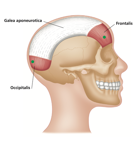 Häufige Triggerpunkte bei Kopfschmerzen