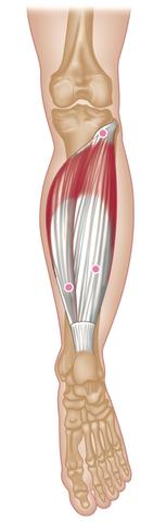 Soleus Trigger Points