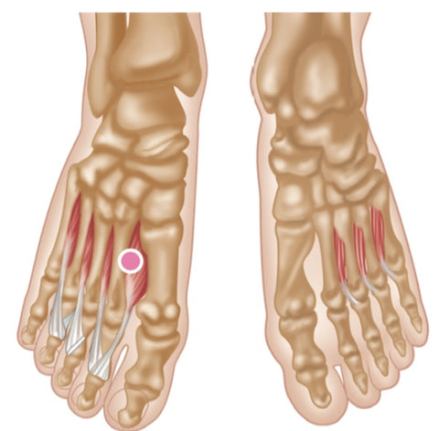 Dorsal Interossei Plantar Interossei Trigger Points