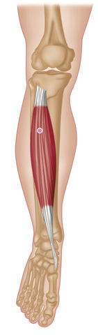 Puntos gatillo anteriores del tibial