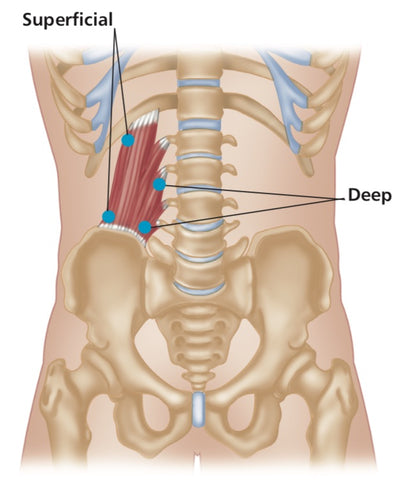 Quadratus lumborum QL Triggerpunktfreigabe