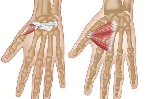 Thenar Eminence Trigger Points