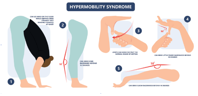 Joint Hypermobility