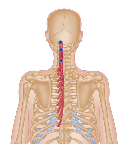 Semispinalis Trigger Points