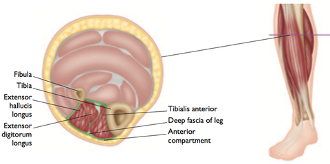 Anterior Compartment Syndrome Trigger Points