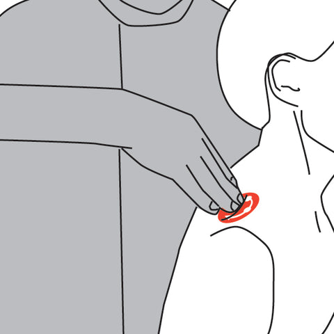 Supraspinatus Trigger Point Therapy