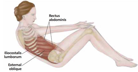 Puntos gatillo de los músculos abdominales