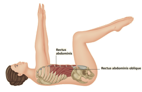 Tratamiento del punto gatillo del recto abdominal