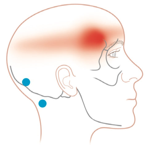 Semispinalis Capitis (obere) Triggerpunkte