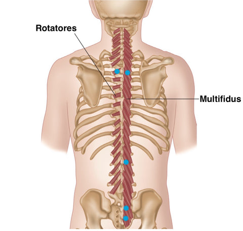 Multifidus Rotatores Triggerpunkte