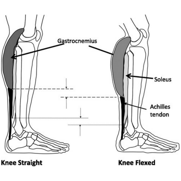 Auslösepunkt des Gastrocnemius soleus