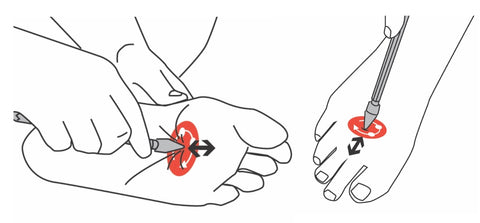 Trigger Points of the Foot