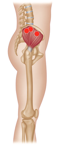 Gluteus Medius Triggerpunkte