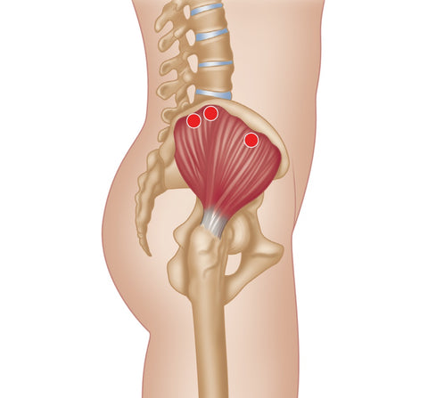 Treating Trigger Points in the Glutes – Stuart Hinds Performance Therapy
