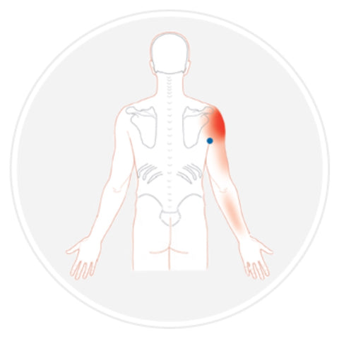 Trigger Point Therapy - Treating Teres Major – Niel Asher Education