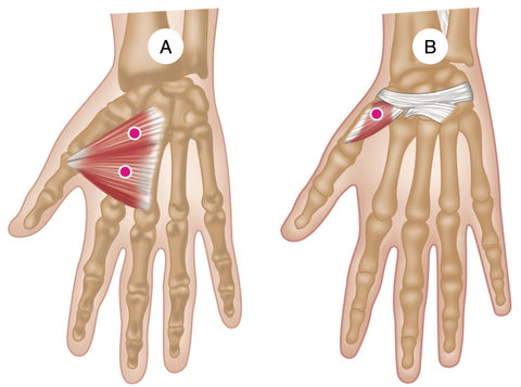 Puntos gatillo del aductor y del oponente del pulgar