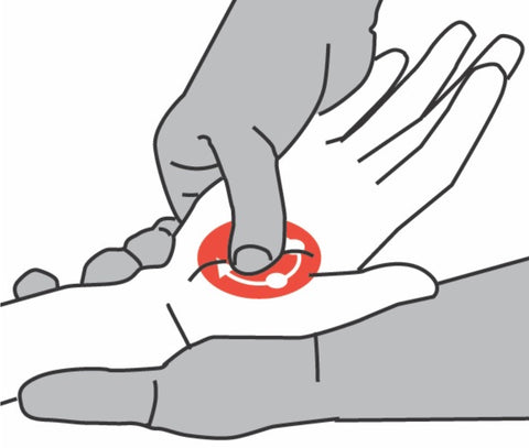 Opponens Pollicis Trigger Points