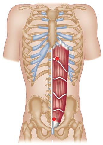 Puntos gatillo del recto abdominal