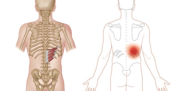 Serratus Posterior-Inferior-Triggerpunkte