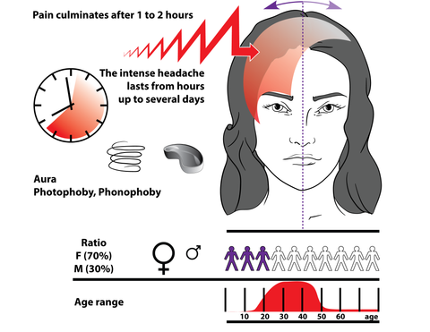 Headache Trigger Points