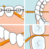 tepe easypick - toothpicks_dentalpick