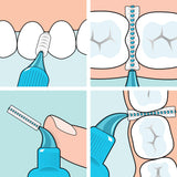 interdentalbrush-clean-your-teeth