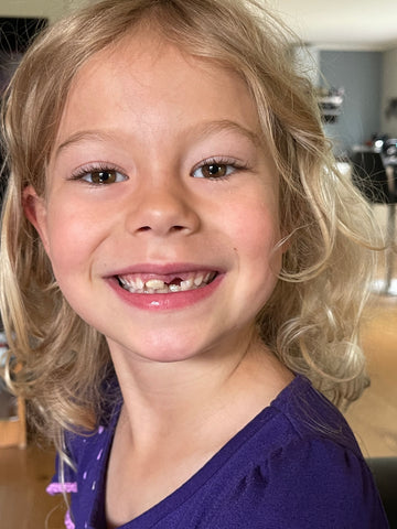 Smiling girl with a missing tooth