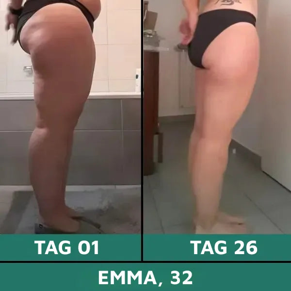 Vorher / Nachher 2