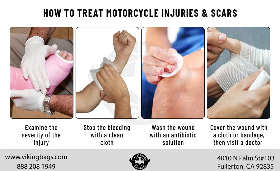 How to Treat Motorcycle Injuries & Scars