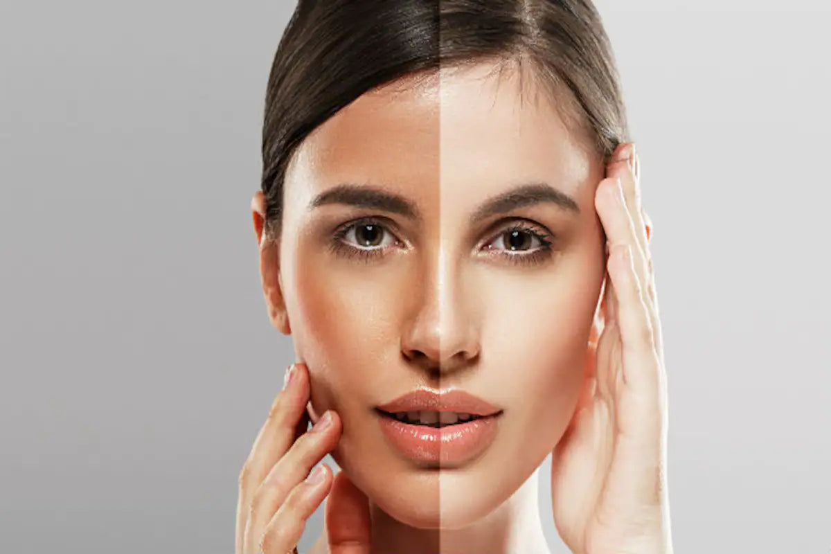 Choosing the Right Whitening Products for Your Skin Type - Premiumdermalmart.com