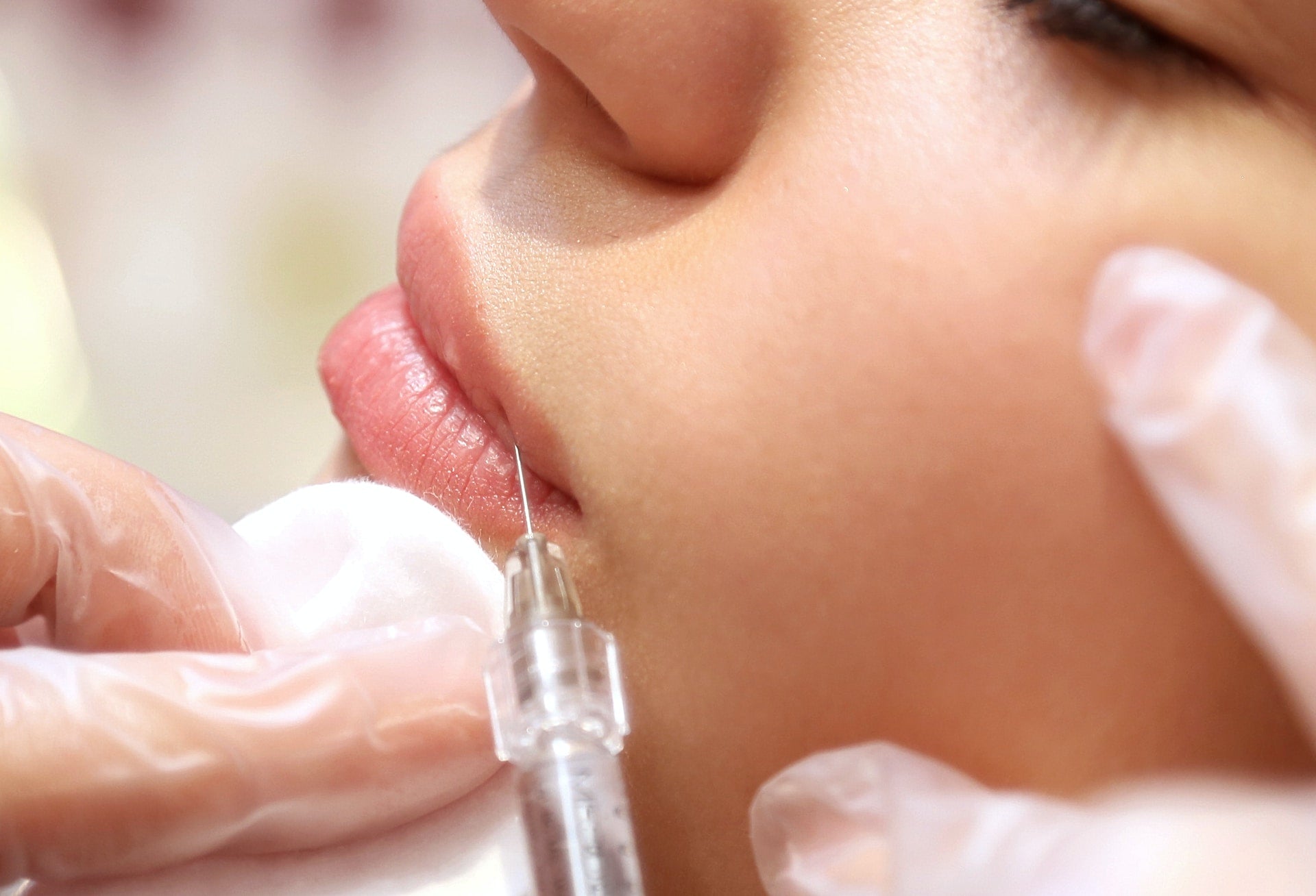 Does Botox hurt more than fillers in cosmetic Applications - Premium Dermal Mart